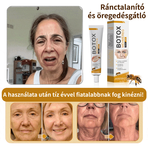 ⚜️⚜️⚜️【Hivatalos Márkabolt】FrissArc™ Botox Méhméreg Ránctalanító Krém
