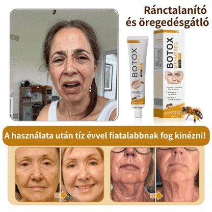⚜️⚜️⚜️【Hivatalos Márkabolt】FrissArc™ Botox Méhméreg Ránctalanító Krém