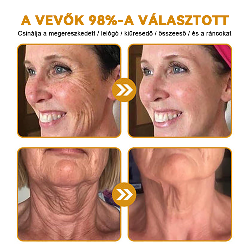 🏵️【Hivatalos Márkabolt】FRISSARC™ Botox Méhméreg Ránctalanító Krém