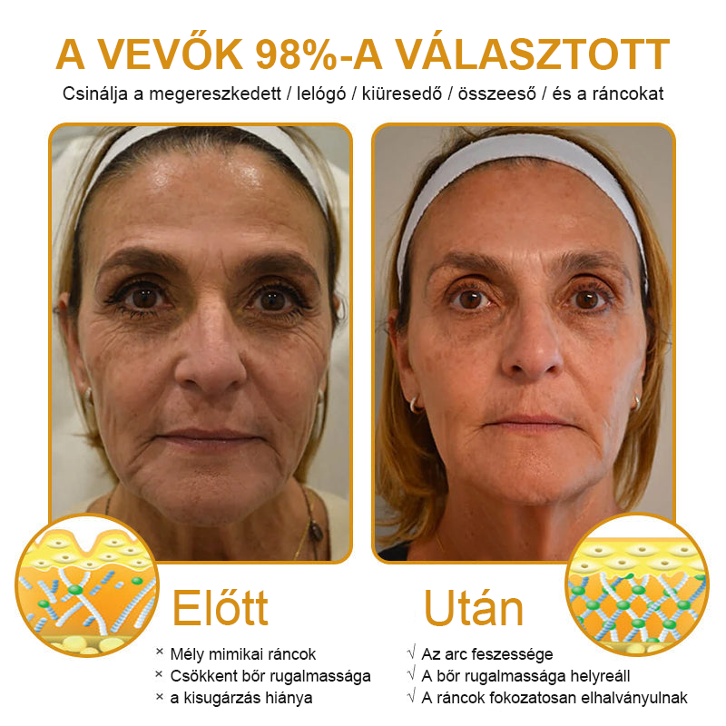 🏵️【Hivatalos Márkabolt】FRISSARC™ Botox Méhméreg Ránctalanító Krém