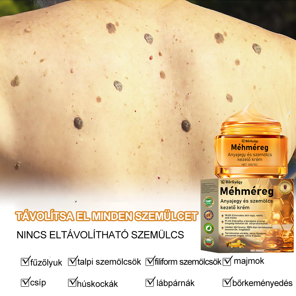 🎉🎉 Gratulálunk, hogy az első 200 rendelés egyike lettél! Élvezd az extra 50% kedvezményt! Cselekedj most, és őrizd meg bőröd egészségét. Ha most lemaradsz, csak jövőre lesz újabb lehetőség!