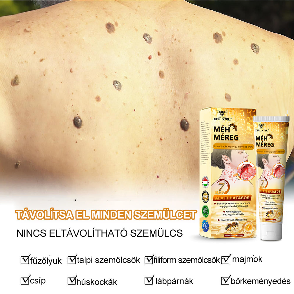 🎁 Csak még 5 doboz van hátra! Extra 50% kedvezményt kínálunk Önnek! Tartsa bőrét egészségesen. Most javítsa meg, különben csak jövőre lesz rá lehetőség.