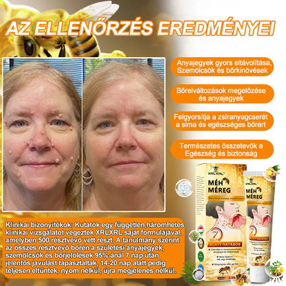 🎁 Csak még 5 doboz van hátra! Extra 50% kedvezményt kínálunk Önnek! Tartsa bőrét egészségesen. Most javítsa meg, különben csak jövőre lesz rá lehetőség.