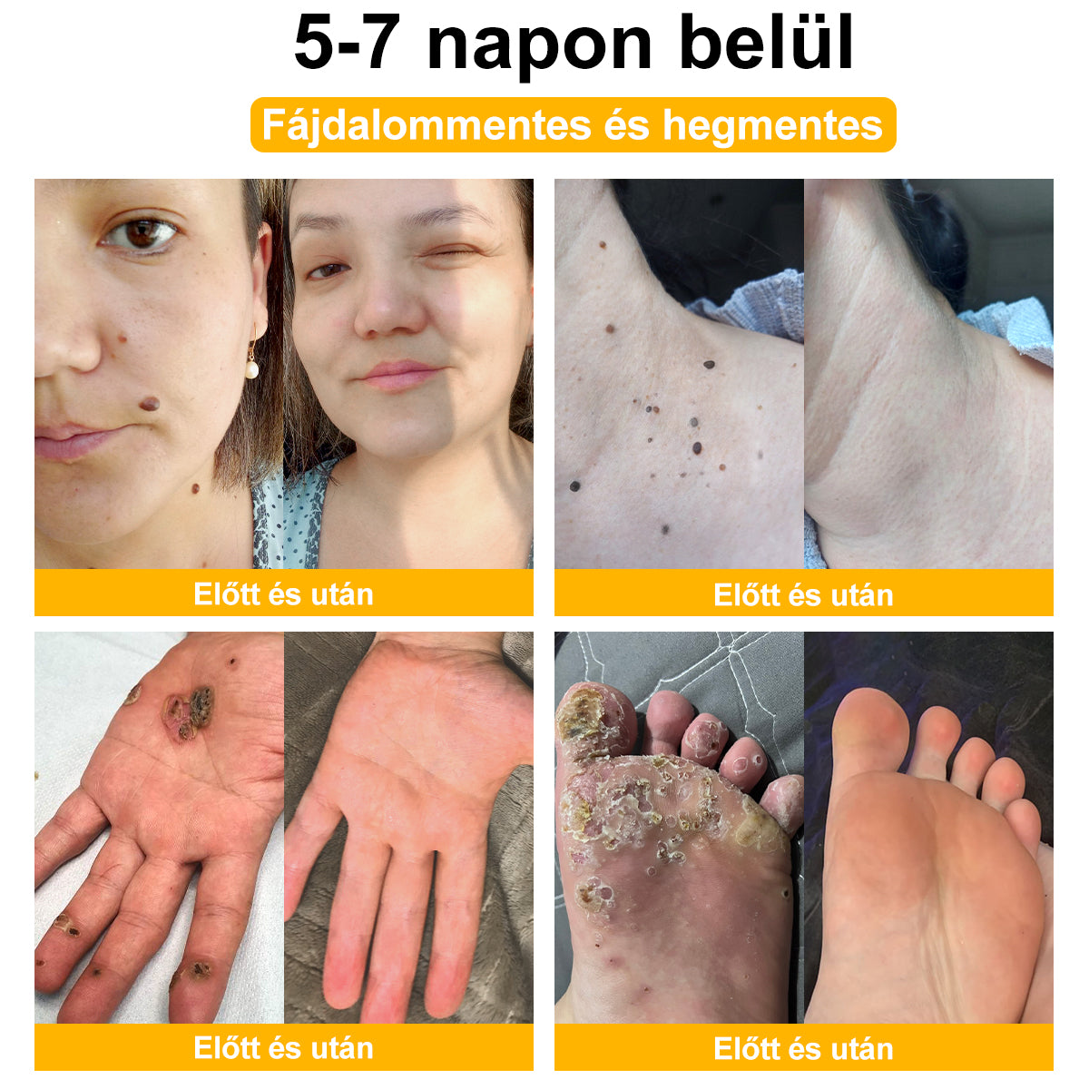 🎁 Csak még 5 doboz van hátra! Extra 50% kedvezményt kínálunk Önnek! Tartsa bőrét egészségesen. Most javítsa meg, különben csak jövőre lesz rá lehetőség.