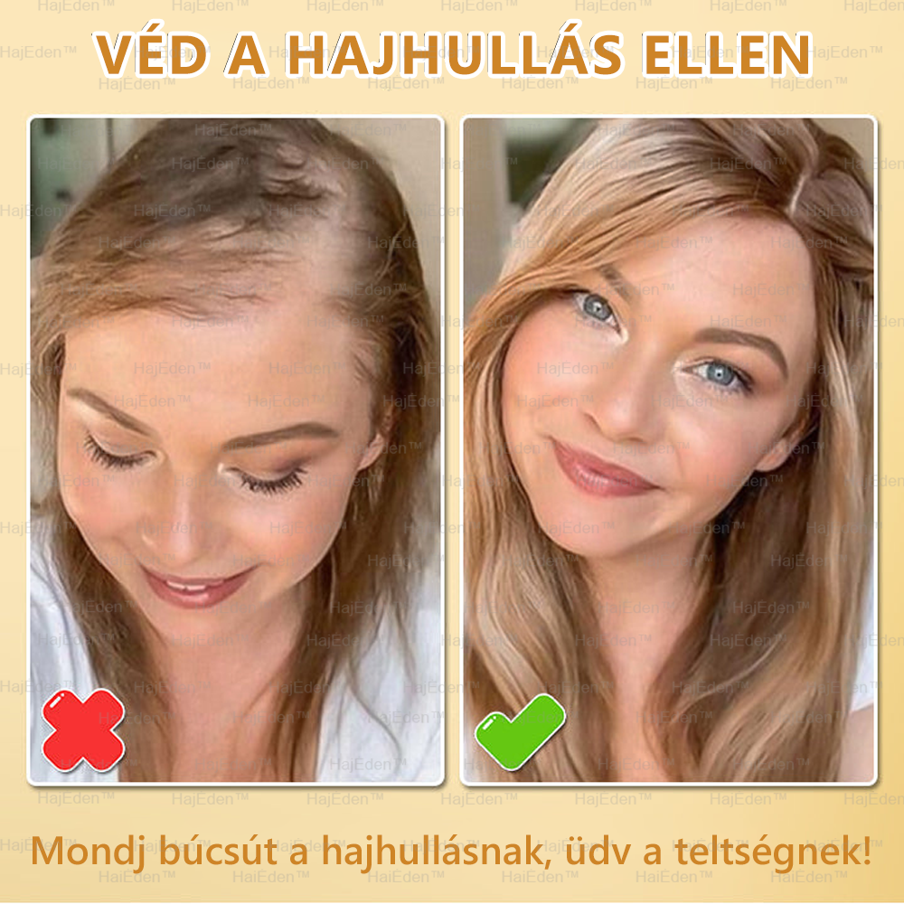 🌞🌞 HajÉden™ BIOTIN HAJNÖVEKEDÉS SZÉRUM