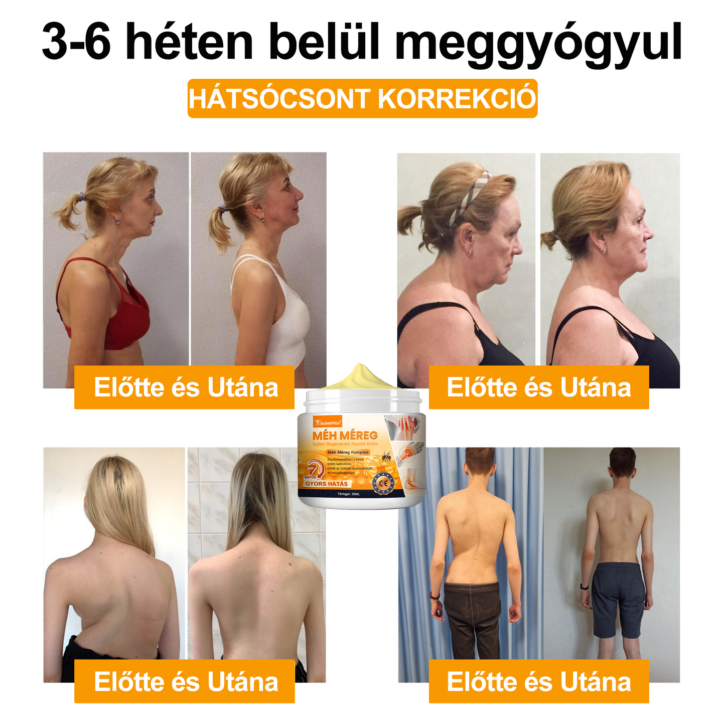 🐝🔥𝐈𝐳𝐮̈𝐥𝐞𝐭𝐢𝐕𝐢𝐭𝐚𝐥™ 𝐌𝐞́𝐡 𝐌𝐞́𝐫𝐞𝐠 𝐈𝐳𝐮̈𝐥𝐞𝐭𝐢 𝐑𝐞𝐠𝐞𝐧𝐞𝐫𝐚́𝐥𝐨 𝐊𝐞𝐳𝐞𝐥𝐨̋ 𝐊𝐫𝐞́𝐦 (𝐔́𝐣-𝐙𝐞́𝐥𝐚𝐧𝐝𝐢 𝐌𝐞́𝐡 𝐊𝐢𝐯𝐨𝐧𝐚𝐭 - 𝐒𝐳𝐚𝐤𝐨𝐬𝐨𝐝𝐢𝐤 𝐨𝐫𝐭𝐨𝐩𝐞́𝐝 𝐛𝐞𝐭𝐞𝐠𝐬𝐞́𝐠𝐞𝐤𝐫𝐞 𝐞́𝐬 𝐢𝐳𝐮̈𝐥𝐞𝐭𝐢 𝐟𝐚́𝐣𝐝𝐚𝐥𝐨𝐦𝐫𝐚)