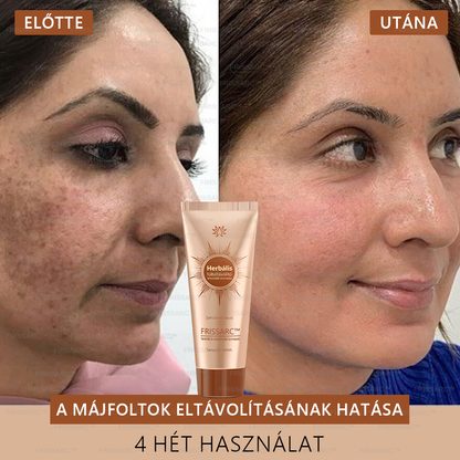 💟💟 FRISSARC™ fehérítő és folteltávolító arcmaszk