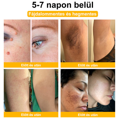 🎁 Csak még 5 doboz van hátra! Extra 50% kedvezményt kínálunk Önnek! Tartsa bőrét egészségesen. Most javítsa meg, különben csak jövőre lesz rá lehetőség.