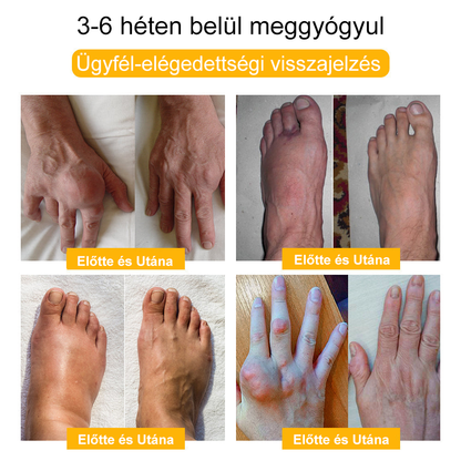 🚀🚀🚀𝐈𝐳𝐮̈𝐥𝐞𝐭𝐢𝐕𝐢𝐭𝐚𝐥™ 𝐌𝐞́𝐡 𝐌𝐞́𝐫𝐞𝐠 𝐈𝐳𝐮̈𝐥𝐞𝐭𝐢 𝐑𝐞𝐠𝐞𝐧𝐞𝐫𝐚́𝐥𝐨 𝐊𝐞𝐳𝐞𝐥𝐨̋ 𝐊𝐫𝐞́𝐦 (𝐔́𝐣-𝐙𝐞́𝐥𝐚𝐧𝐝𝐢 𝐌𝐞́𝐡 𝐊𝐢𝐯𝐨𝐧𝐚𝐭 - 𝐒𝐳𝐚𝐤𝐨𝐬𝐨𝐝𝐢𝐤 𝐨𝐫𝐭𝐨𝐩𝐞́𝐝 𝐛𝐞𝐭𝐞𝐠𝐬𝐞́𝐠𝐞𝐤𝐫𝐞 𝐞́𝐬 𝐢𝐳𝐮̈𝐥𝐞𝐭𝐢 𝐟𝐚́𝐣𝐝𝐚𝐥𝐨𝐦𝐫𝐚)