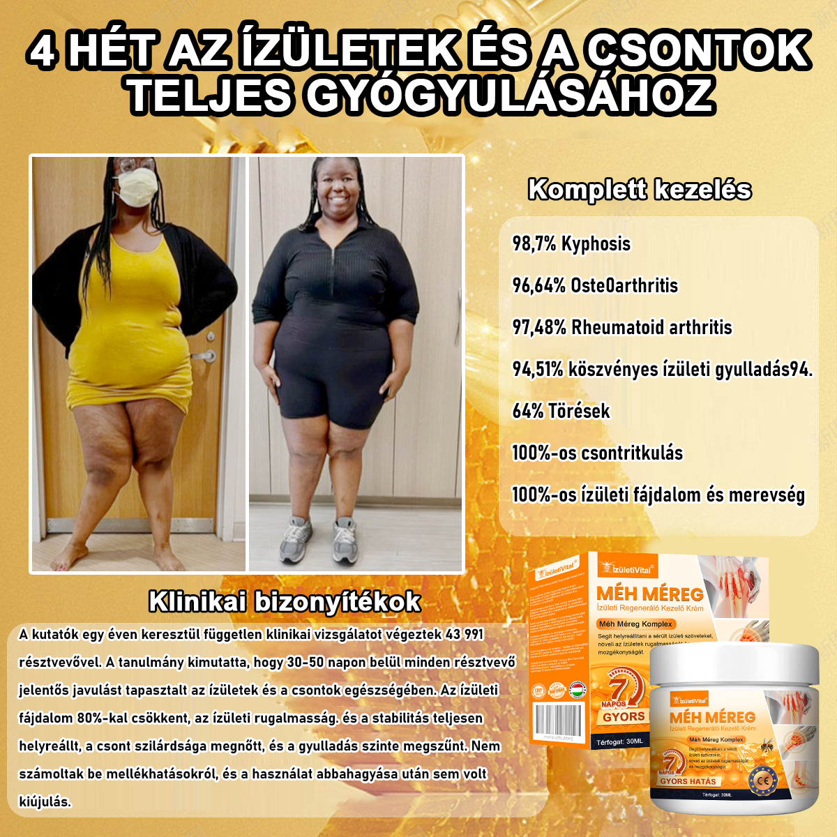 🚀🚀🚀𝐈𝐳𝐮̈𝐥𝐞𝐭𝐢𝐕𝐢𝐭𝐚𝐥™ 𝐌𝐞́𝐡 𝐌𝐞́𝐫𝐞𝐠 𝐈𝐳𝐮̈𝐥𝐞𝐭𝐢 𝐑𝐞𝐠𝐞𝐧𝐞𝐫𝐚́𝐥𝐨 𝐊𝐞𝐳𝐞𝐥𝐨̋ 𝐊𝐫𝐞́𝐦 (𝐔́𝐣-𝐙𝐞́𝐥𝐚𝐧𝐝𝐢 𝐌𝐞́𝐡 𝐊𝐢𝐯𝐨𝐧𝐚𝐭 - 𝐒𝐳𝐚𝐤𝐨𝐬𝐨𝐝𝐢𝐤 𝐨𝐫𝐭𝐨𝐩𝐞́𝐝 𝐛𝐞𝐭𝐞𝐠𝐬𝐞́𝐠𝐞𝐤𝐫𝐞 𝐞́𝐬 𝐢𝐳𝐮̈𝐥𝐞𝐭𝐢 𝐟𝐚́𝐣𝐝𝐚𝐥𝐨𝐦𝐫𝐚)