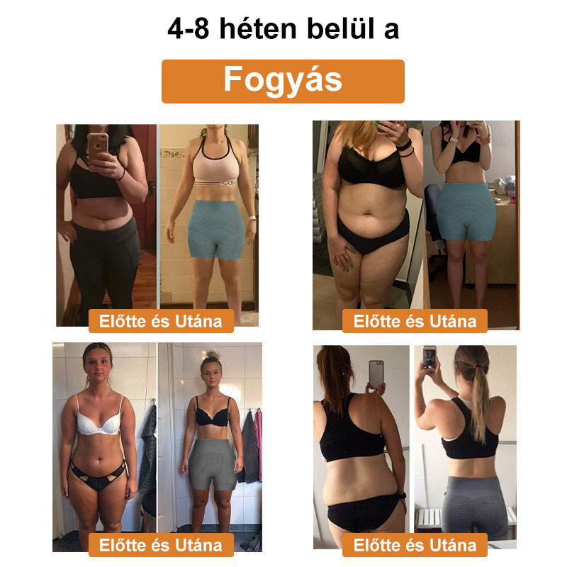 ⚜️⚜️【2024 őszi újdonság】]Iontartalmú mikro-vibrációs masszázsformáló rövidnadrág （⭐Formázás⭐Terhességi csíkok eltávolítása⭐Narancsbőr eltávolítása）