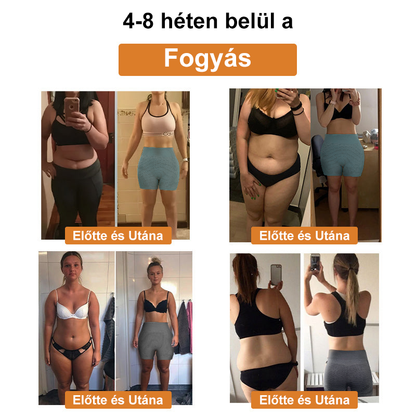 ⚜️⚜️【2024 őszi újdonság】]Iontartalmú mikro-vibrációs masszázsformáló rövidnadrág （⭐Formázás⭐Terhességi csíkok eltávolítása⭐Narancsbőr eltávolítása）