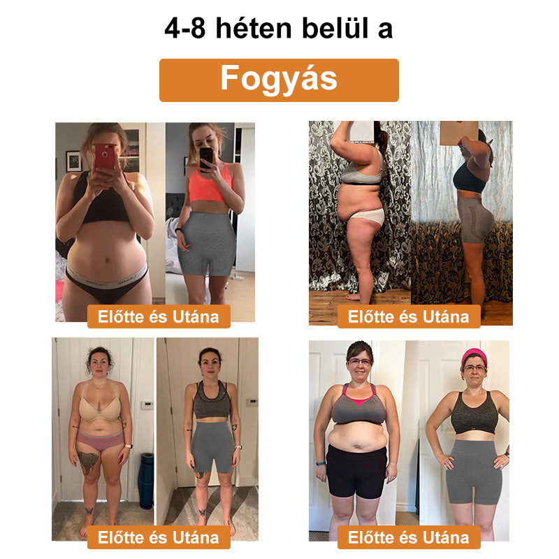 ⚜️⚜️【2024 őszi újdonság】]Iontartalmú mikro-vibrációs masszázsformáló rövidnadrág （⭐Formázás⭐Terhességi csíkok eltávolítása⭐Narancsbőr eltávolítása）