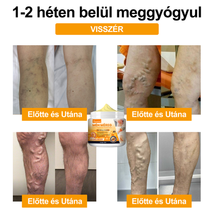 🐝🔥𝐈𝐳𝐮̈𝐥𝐞𝐭𝐢𝐕𝐢𝐭𝐚𝐥™ 𝐌𝐞́𝐡 𝐌𝐞́𝐫𝐞𝐠 𝐈𝐳𝐮̈𝐥𝐞𝐭𝐢 𝐑𝐞𝐠𝐞𝐧𝐞𝐫𝐚́𝐥𝐨 𝐊𝐞𝐳𝐞𝐥𝐨̋ 𝐊𝐫𝐞́𝐦 (𝐔́𝐣-𝐙𝐞́𝐥𝐚𝐧𝐝𝐢 𝐌𝐞́𝐡 𝐊𝐢𝐯𝐨𝐧𝐚𝐭 - 𝐒𝐳𝐚𝐤𝐨𝐬𝐨𝐝𝐢𝐤 𝐨𝐫𝐭𝐨𝐩𝐞́𝐝 𝐛𝐞𝐭𝐞𝐠𝐬𝐞́𝐠𝐞𝐤𝐫𝐞 𝐞́𝐬 𝐢𝐳𝐮̈𝐥𝐞𝐭𝐢 𝐟𝐚́𝐣𝐝𝐚𝐥𝐨𝐦𝐫𝐚)